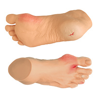 Common Foot Problems Display