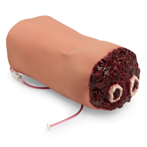 Amputated Bleeding Arm SMART STAT