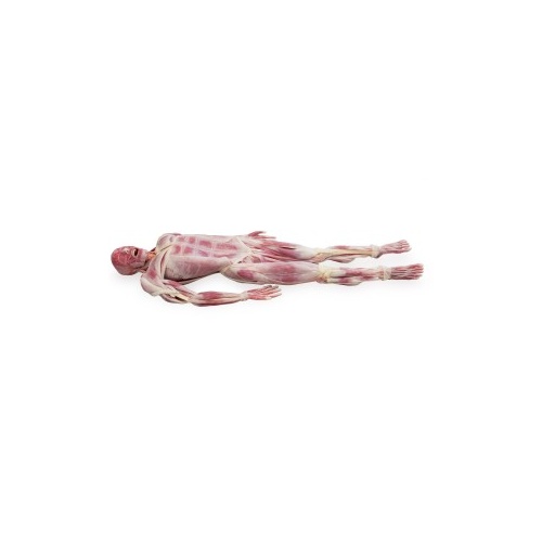 Synthetic Cadaver- SynDaver Musculoskeletal Model