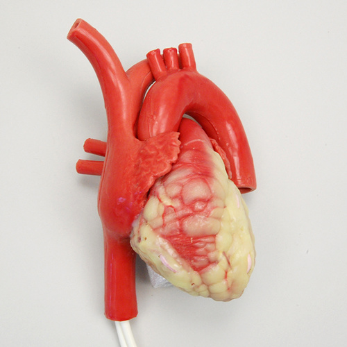 CABG Beating Heart
