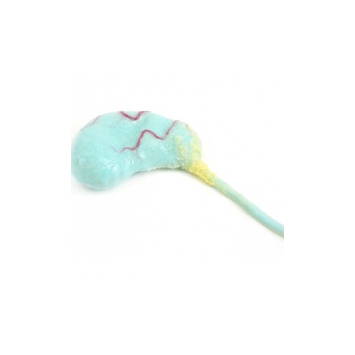 Gall Bladder