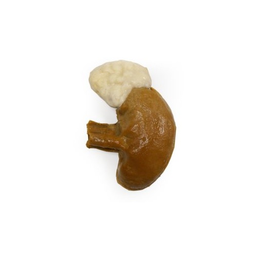 Kidney