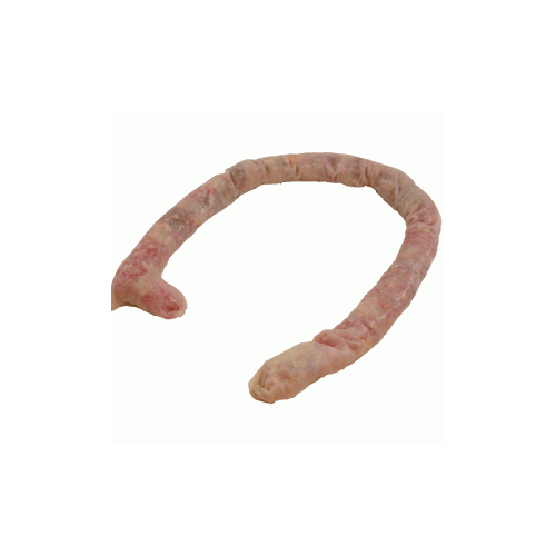 Large Intestine