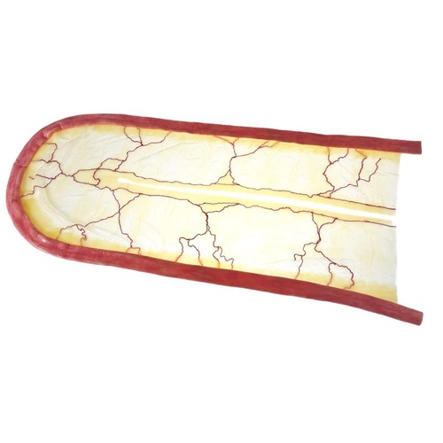 SynDaver SynTissue Complex Small Intestine