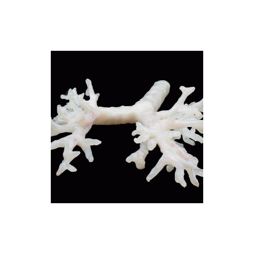 Trachea
