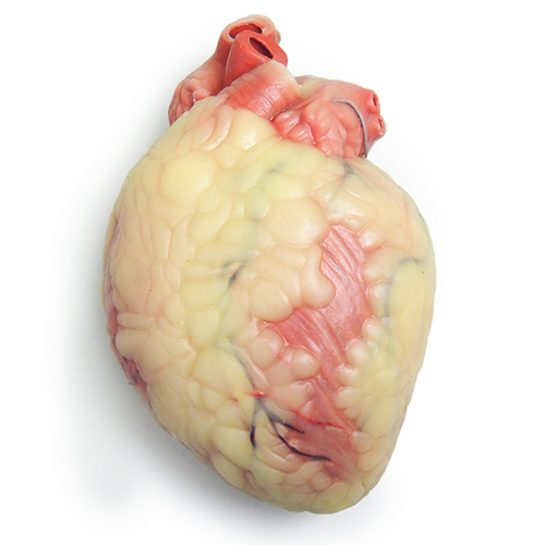 Ischemic (Enlarged) Beating Heart Trainer