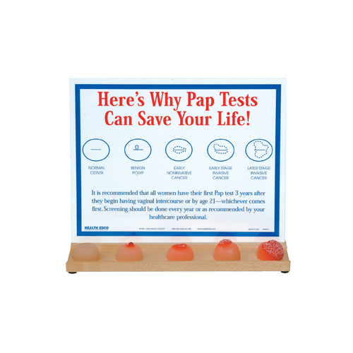 Feel for Yourself: Cervix Conditions Display