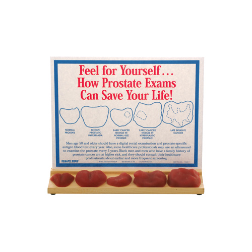Prostate Exams Display