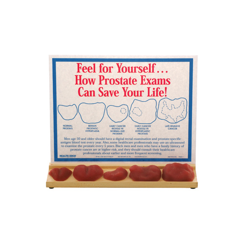 Prostate Exams Display