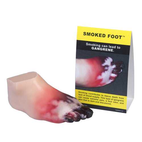 Smoked Foot Gangrene Model