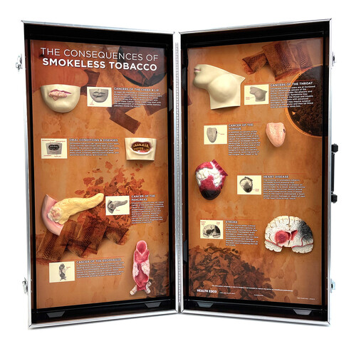 Smokeless Tobacco Consequences 3D Display