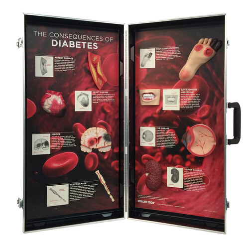 The Consequences of Diabetes 3D Display