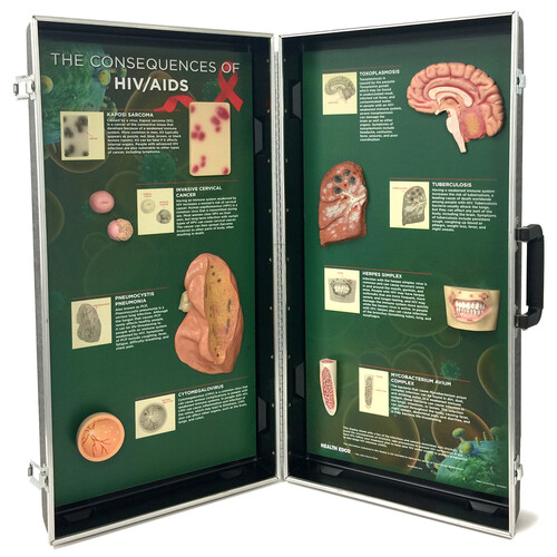 The Consequences of HIV/AIDS 3-D Display