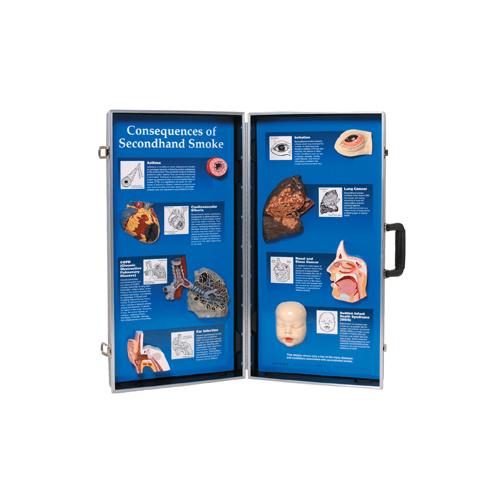 The Consequences of Second hand Smoke 3D Display