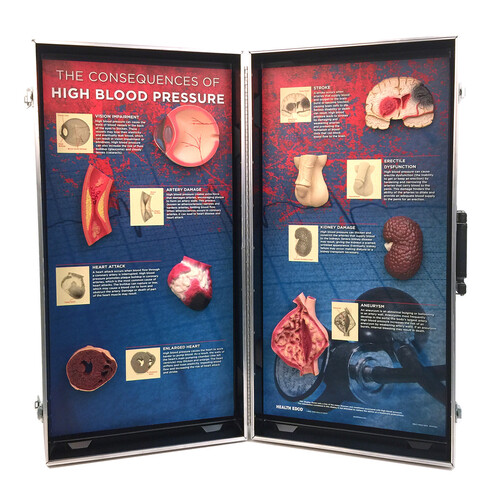 The Consequences of High Blood Pressure