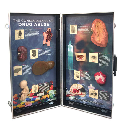 The Consequences of Drug Abuse 3D Display