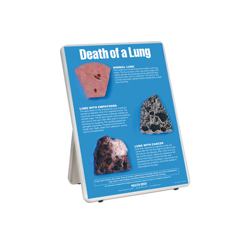 Death of a Lung Easel Display
