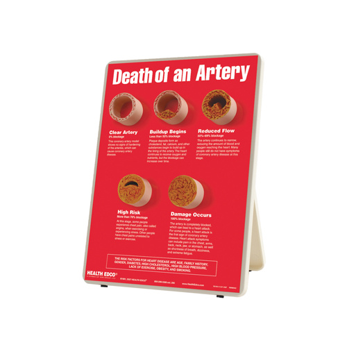 Death of an Artery Easel Display