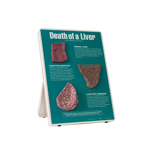 Death of a Liver Easel Display