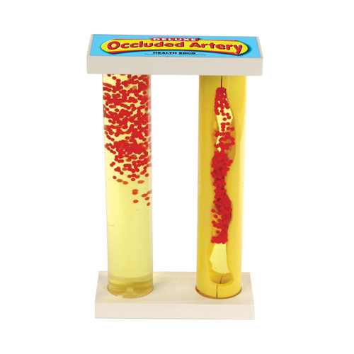 Deluxe Occluded Artery Model