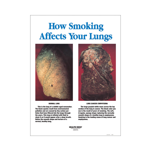 How Smoking Affects Your Lungs Framed Chart