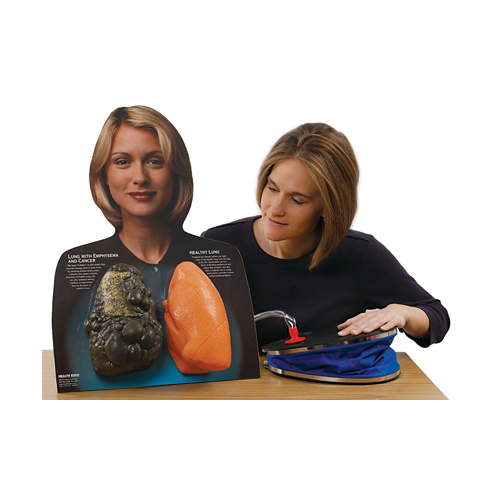 Lou-Wheeze Smoker's Lungs Comparison Model