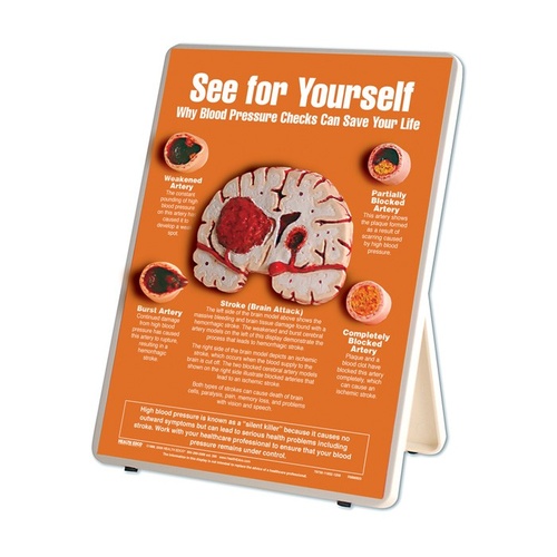 Blood Pressure Checks Easel Display