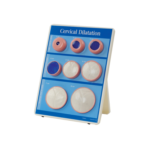 Cervical Dilatation Easel Display