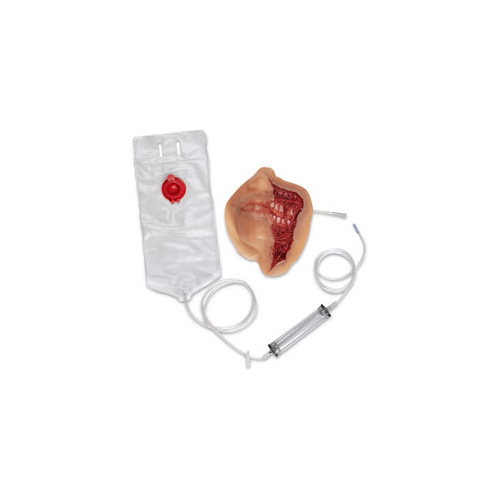 Wound - Exposed Denture Avulsion