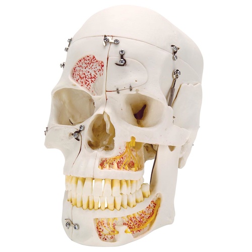 Anatomical Model- Deluxe Human Demonstration Dental Skull Model, 10 part