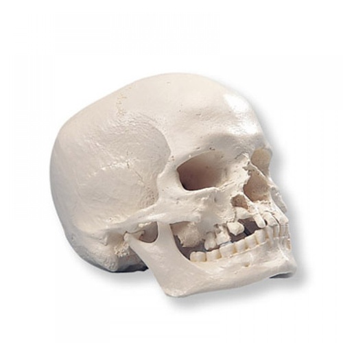 Anatomical Model- Human Skull Model with Cleft Jaw and Palate