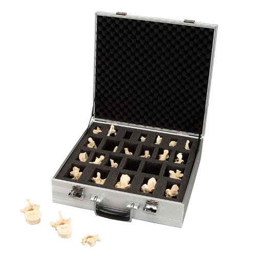 Anatomical Model- Set of 24 BONElike Vertebrae Models