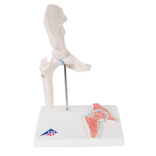 Anatomical Mini Hip Joint with Cross-section Model