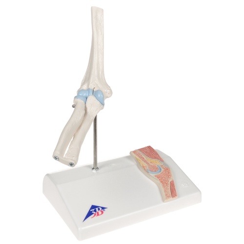 Anatomical Mini Elbow Joint with Cross-section Model