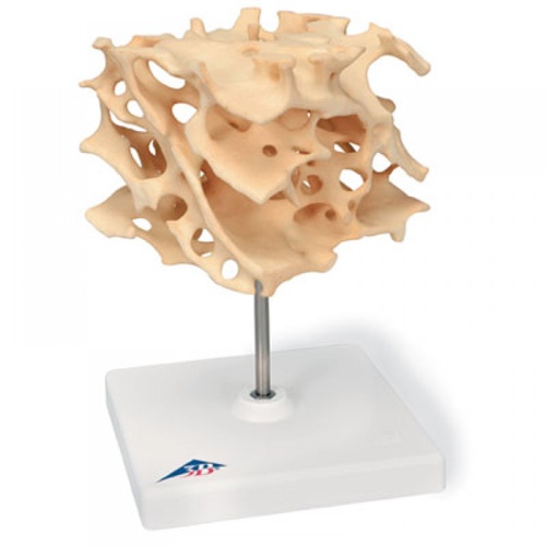 Cancellous bone