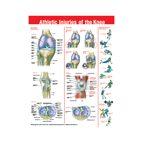 Athletic Injuries of the Knee Chart