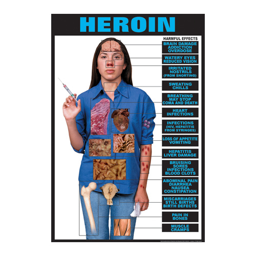 Heroin - HE