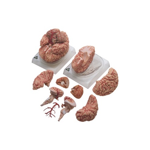 Brain with Arteries
