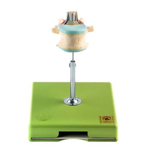 LUMBAR VERTEBRA (LII) W S/CORD