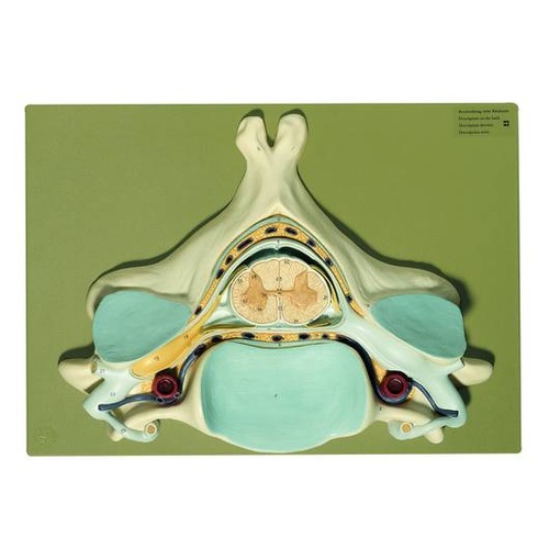 Fifth Cervical Vertebra