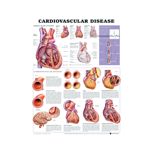 Anatomical Cardiovascular Disease Chart