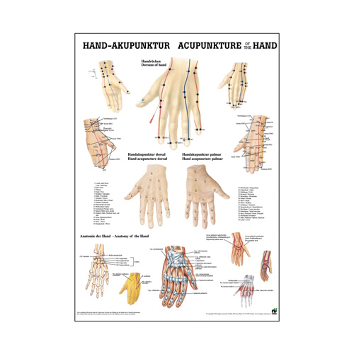 Acupuncture of the Hand
