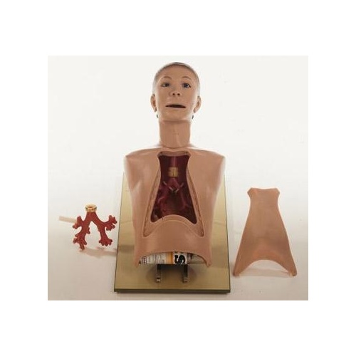 Bronchoscopy Model - Sick Boy With Healthy And Sicky Bronchial Tree