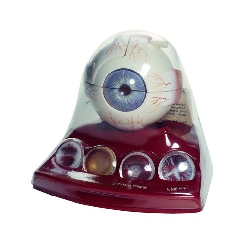Cataract Eye Model