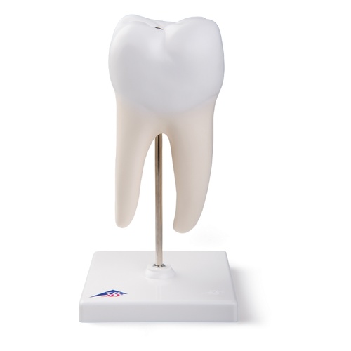 Anatomical Model- Lower Twin-Root Molar showing cavities, 2 part