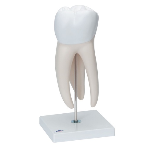 Anatomical Upper Triple Root Molar with Dental Cavities Model 6 part