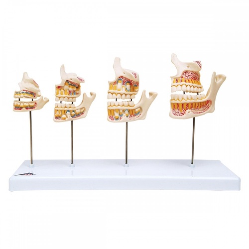 Anatomical Model- Dentition Development