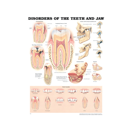 Anatomical Disorders of the Teeth and Jaw Chart