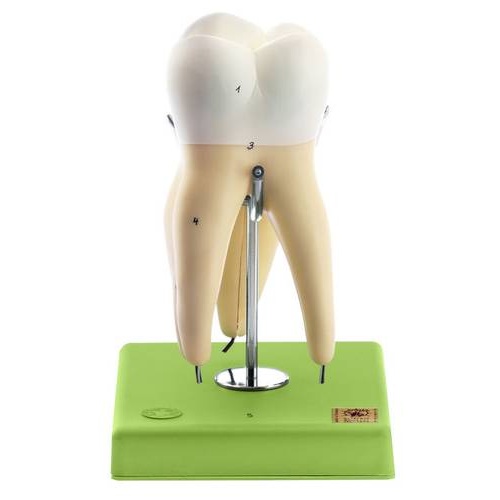 First Upper Molar with Three Roots