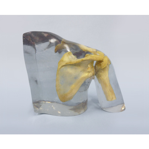 X-ray Phantom Shoulder, Transparent
